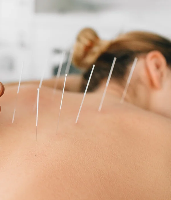 ACUPUNCTURE-OSHAWA-2