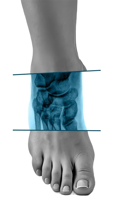 Why Foot Image