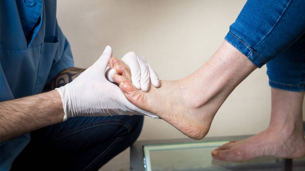 Chiropodist or Physiotherapist conducts diagnostics, foot test of a for the manufacture of individual, orthopedic insoles