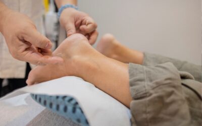 Combining Physio and Acupuncture in Whitby for Faster Chronic Pain Relief